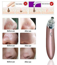Load image into Gallery viewer, Vacuum Pro Pore Cleaner