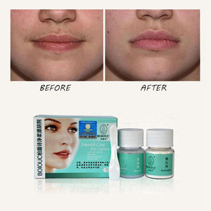 Face Fine Hair Beard Eyebrow Hair Removal Facial Hair Bleaching Set RemoveBeauty New Arrival