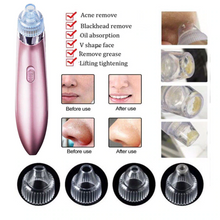 Load image into Gallery viewer, Vacuum Pro Pore Cleaner