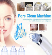 Load image into Gallery viewer, Vacuum Pro Pore Cleaner